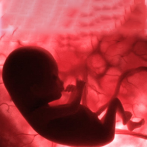 Fetal therapy